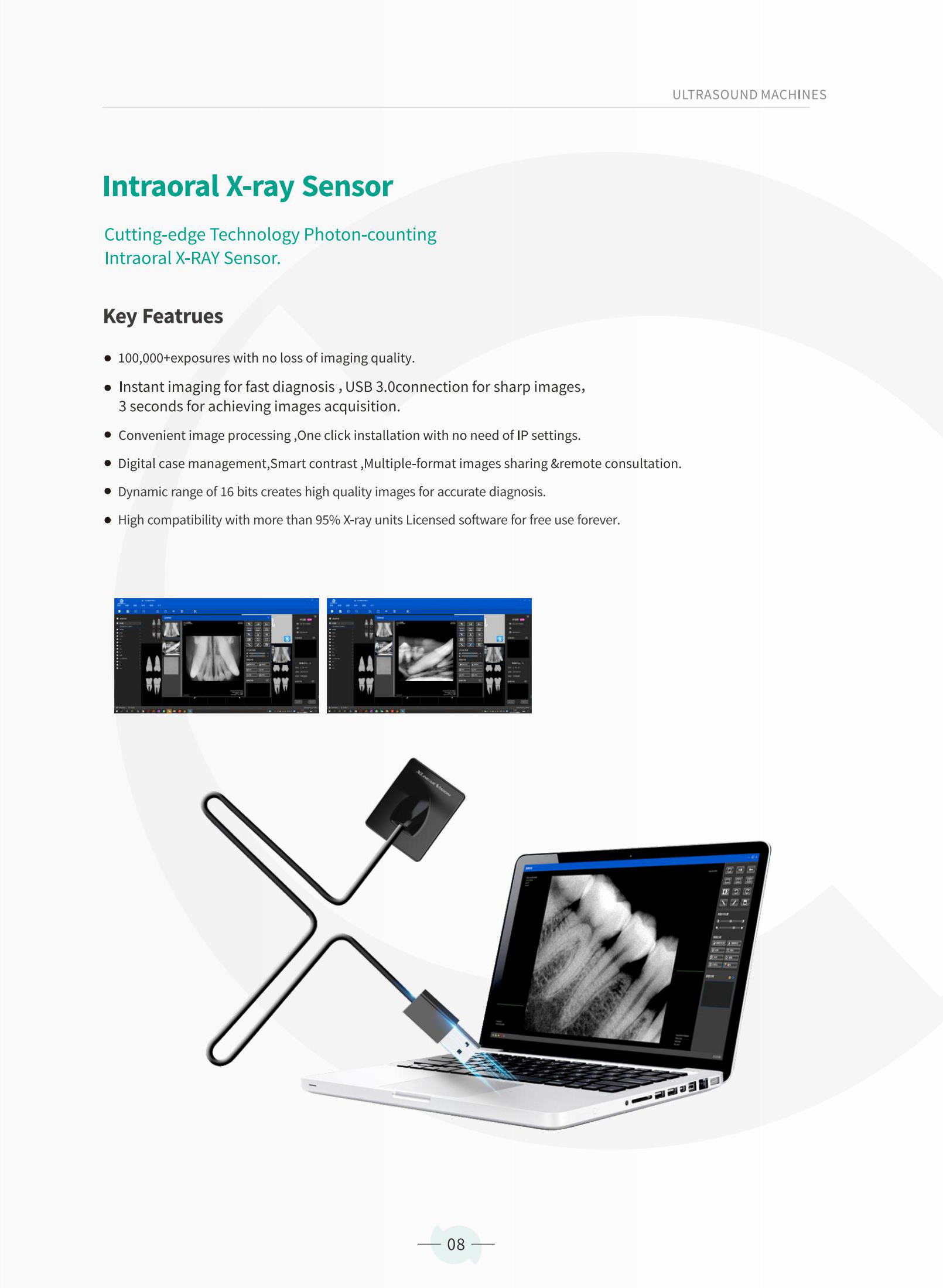 Intraoral X-ray.png